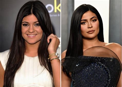 jenner kylie|kylie jenner before and after.